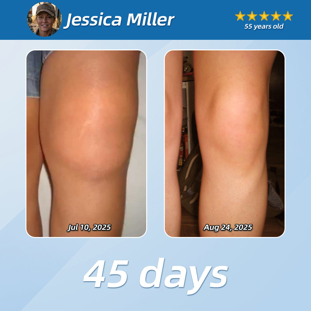 [New Year Special Offer] CureVivo® Pain Relief& Repair Lotion🤶For Muscle, Joint & Nerve Pain